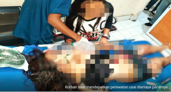 Akibat 27 Luka Tusukan, Nyawa Remaja Cantik Asal Tomohon Akhirnya&nbsp;Meninggal